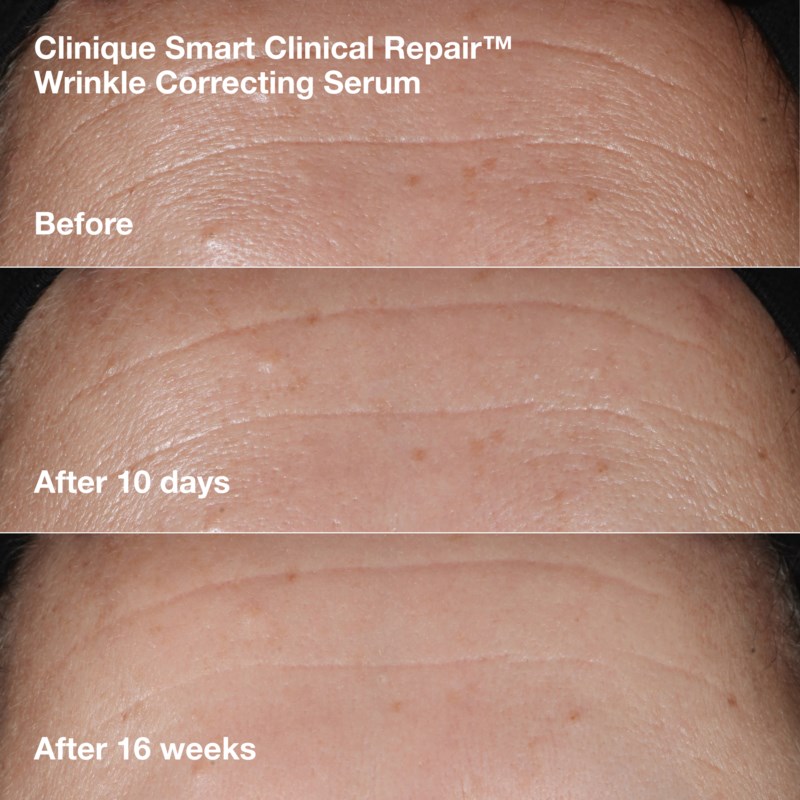 Clinique Wrinkle-Correcting Routine Set hudvårdsset dam – bild 9