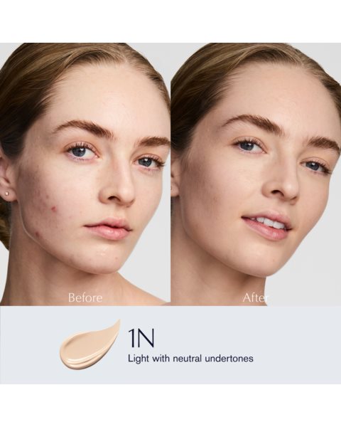 placeholder-image