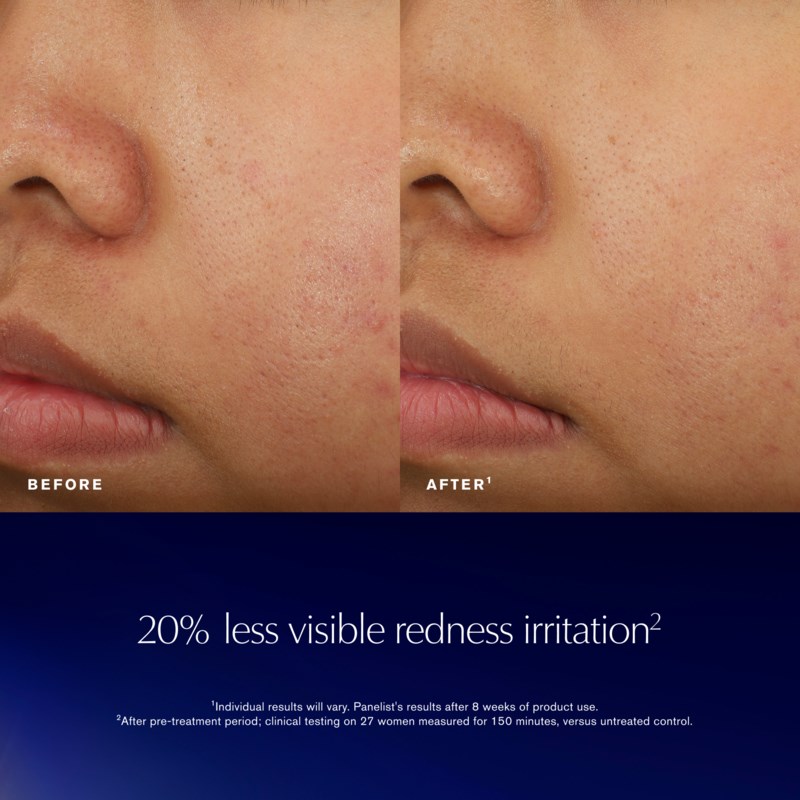 Estée Lauder Advanced night repair recovery treatment essence serum dam – bild 9